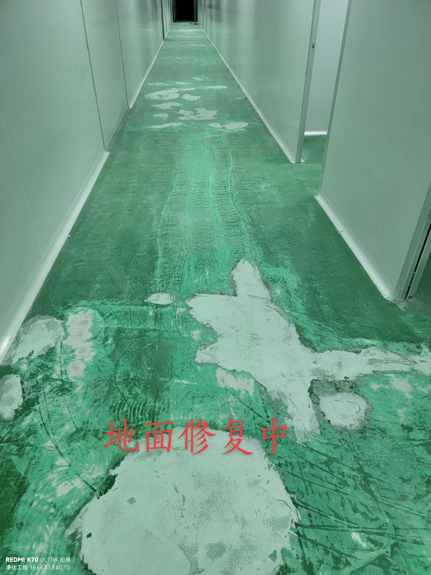 粉化伴随脱落根治方案